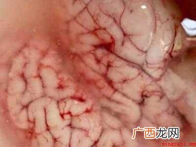 脑花怎么做才好吃的具体操作步骤 脑花怎么做才好吃