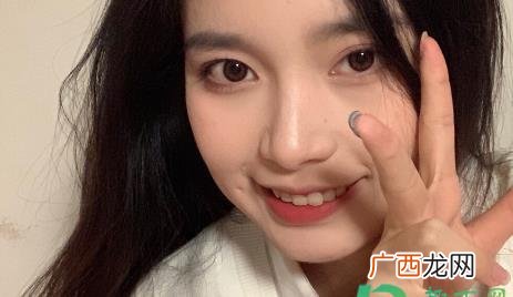 疣会接触传染吗 碰到有疣的人会传染吗