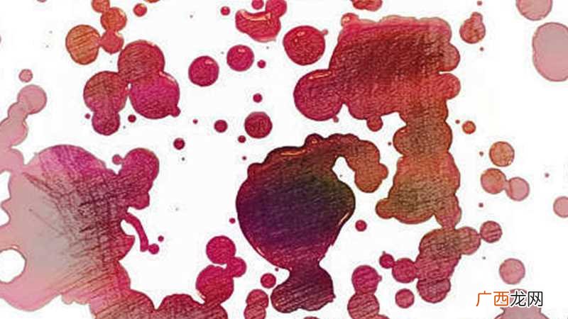 梦到自己流了很多血是什么意思呢 梦到自己流了很多血是什么意思