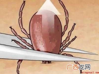 怎么杀死蜱虫的具体操作步骤 怎么杀死蜱虫