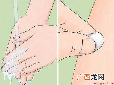 怎么杀死蜱虫的具体操作步骤 怎么杀死蜱虫