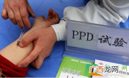 ppd是什么检查怎么做疼吗 ppd是什么检查怎么做