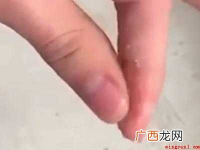502沾了手上怎么弄掉的具体操作步骤 502沾了手上怎么弄掉