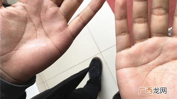 男性断掌说明男人命好不好 男的断掌代表什么意思