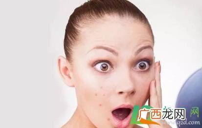 人中总是长痘是什么原因 人中总是长痘怎么回事