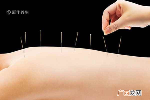 急救采用放血疗法别自己瞎扎! 什么是放血疗法