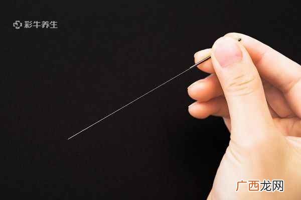 急救采用放血疗法别自己瞎扎! 什么是放血疗法