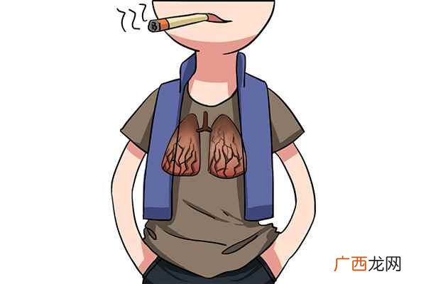 肺癌的15个征兆
