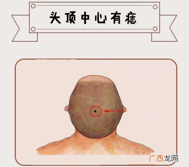 男人面部十大福痣图解 男人脸上十大吉痣