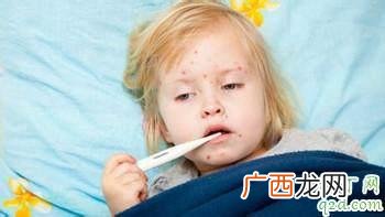 出水痘要注意什么 出水痘要注意些什么