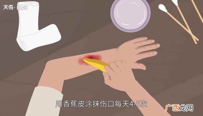 香蕉皮能吃吗 香蕉皮可以吃吗