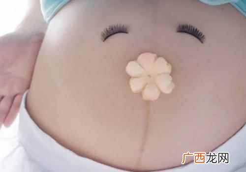 每个孕妇都有妊娠线吗 妊娠线每个孕妇都有吗