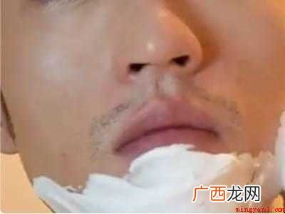 胡茬黑黑的怎么去掉的具体操作步骤 胡茬黑黑的怎么去掉