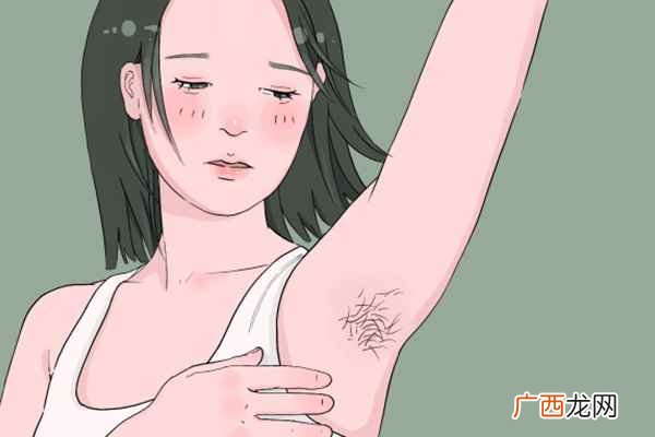 激光脱毛有什么危害 激光脱毛的危害
