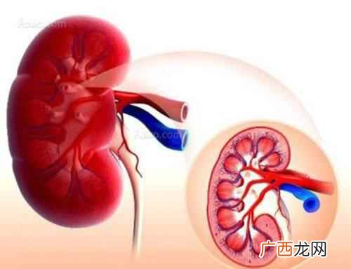 尿路结石输尿管结石等结石疾病会引发尿路狭窄等疾病 尿毒症早期症状表现