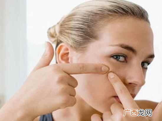 色素沉积分2种青春痘需对症下药 青春痘留下的疤痕怎么去掉
