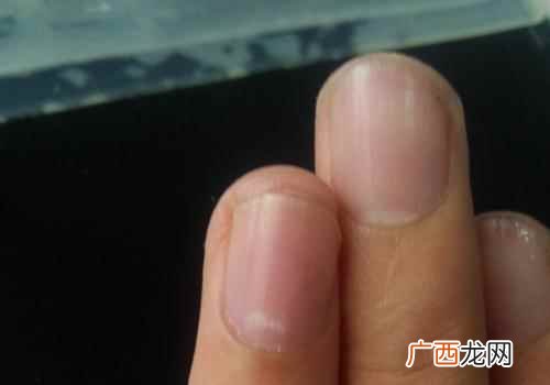 指甲无光泽是怎么回事儿 指甲无光泽是怎么回事
