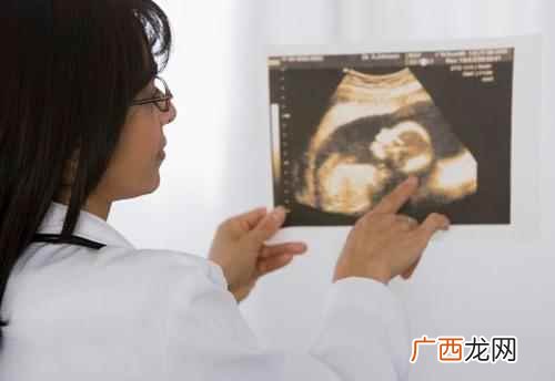 脐带绕颈是什么原因造成的孕晚期 脐带绕颈是什么原因造成的