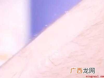 怎样用家里的材料去腿毛的具体操作步骤 怎样用家里的材料去腿毛
