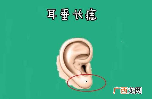 一等好命痣 3种富可敌国的痣相