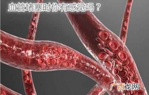 血管堵塞的原因是什么 血管堵塞的原因