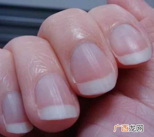 指甲上月牙越来越少是怎么回事 指甲上的月牙越来越少是怎么回事