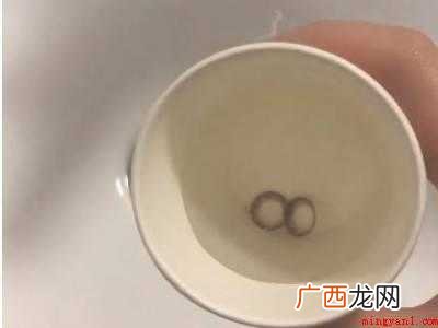隐形眼镜没有护理液怎么保存一晚上