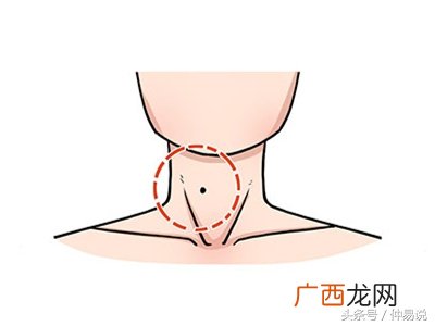 女人富贵痣图解 哪里长痣最好