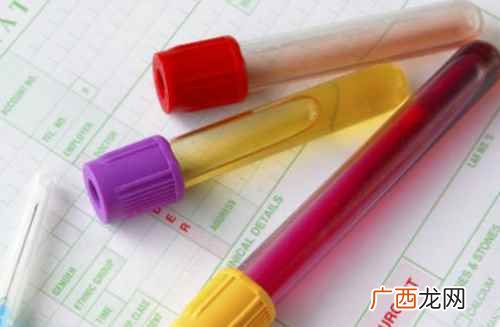 血红蛋白正常值多少 血红蛋白正常值