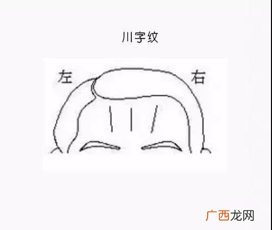 男人额头各种纹面相 额头横纹的男人命运