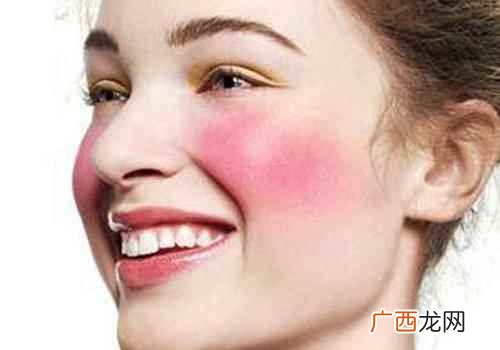 红血丝怎么消除最有效 红血丝怎么消除