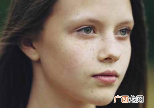 护肤不当是脸上长色斑的重要原因 色斑形成的原因是什么