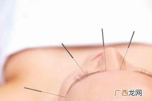 针灸的作用与功效 针灸的作用