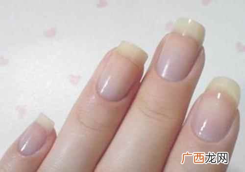 手指甲和肉分离是怎么回事特别疼 手指甲和肉分离是怎么回事