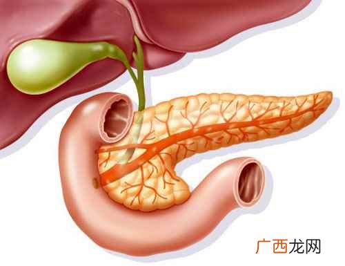 胰腺炎吃什么药好得快 胰腺炎饮食应注意什么