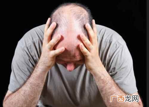 脂溢性脱发原因及解决方法 脱发的原因及防治,脱发原因及解决办法