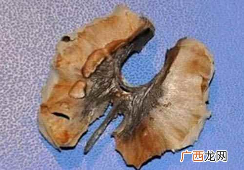 核桃的分心木的功效与服用方法 核桃分心木泡水喝的功效和禁忌