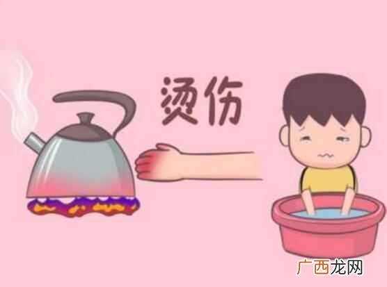儿童烫伤应怎样处理若不幸发生烧烫伤事件 儿童烫伤应怎么处理