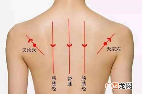 拔罐后背黑紫什么原因 后背拔罐的位置示意图