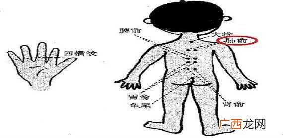小儿肺俞准确位置图片视频 小儿肺俞准确位置图片