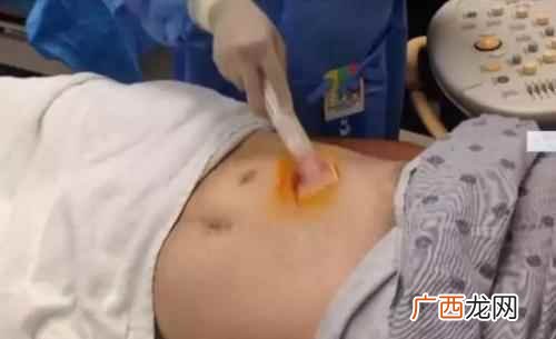 千万不要到非正规医院就诊 肝穿刺活检