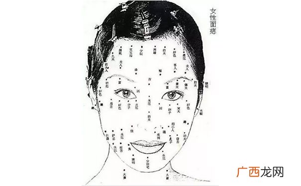 面部风水学脸上的痣详解 女脸上长痣面相图解