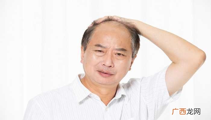 梦见自己秃顶