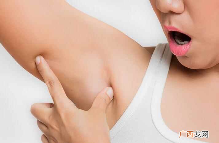 好发部位在乳房下、腋下、胯下与臀部化脓性汗腺炎 化脓性汗腺炎怎么治疗