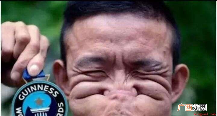 人的相貌是天生的,有美有丑,甚至成了世界上最丑的人
