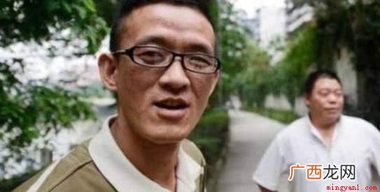 人的相貌是天生的,有美有丑,甚至成了世界上最丑的人