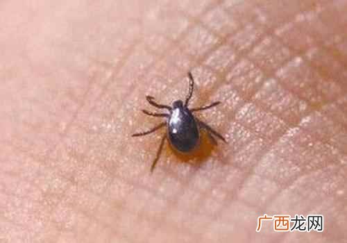 蜱虫叮咬后怎么处理最有效 蜱虫叮咬后怎么处理