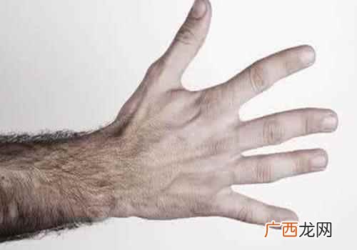 女生脸上汗毛多怎么办 女生脸上汗毛重怎么办