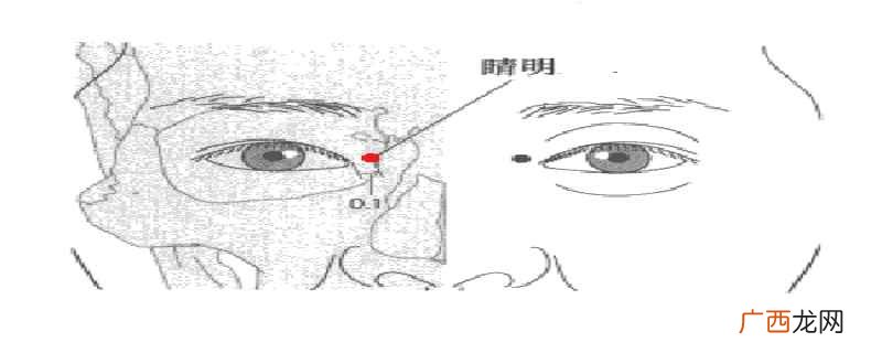 睛明穴位准确位置图视频 睛明的准确位置图