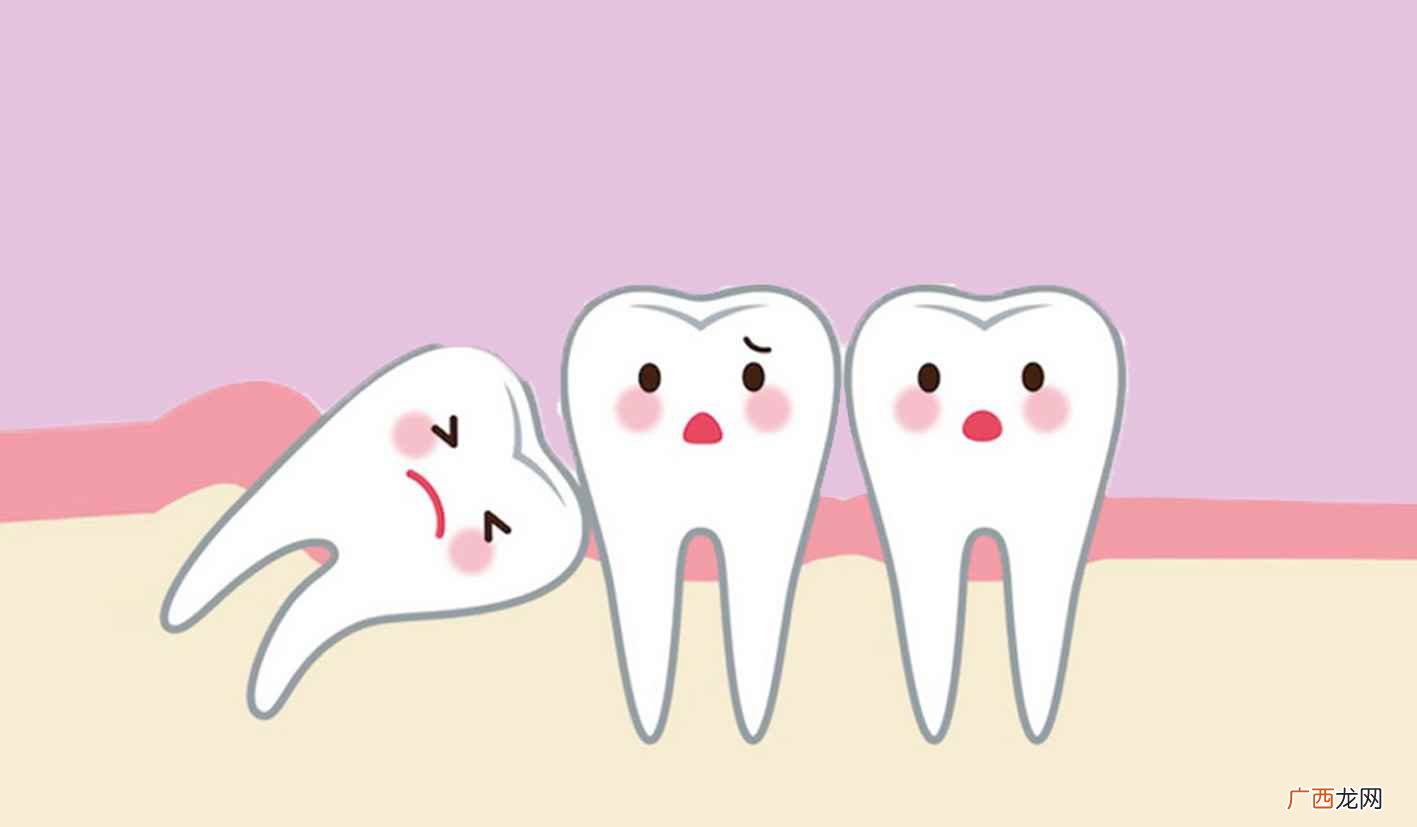 智齿冠周炎发生的原因 智齿是什么